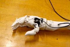 3D PRINTED PROSTHETIC HAND WITH MICROCONTROLLER AND EMG SENSORS ● D. Alqallaf, A. Mathai